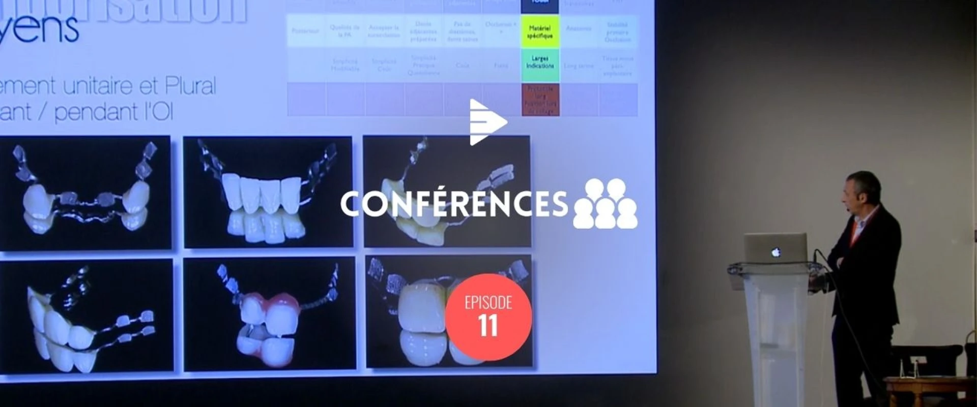 La temporisation en implantologie