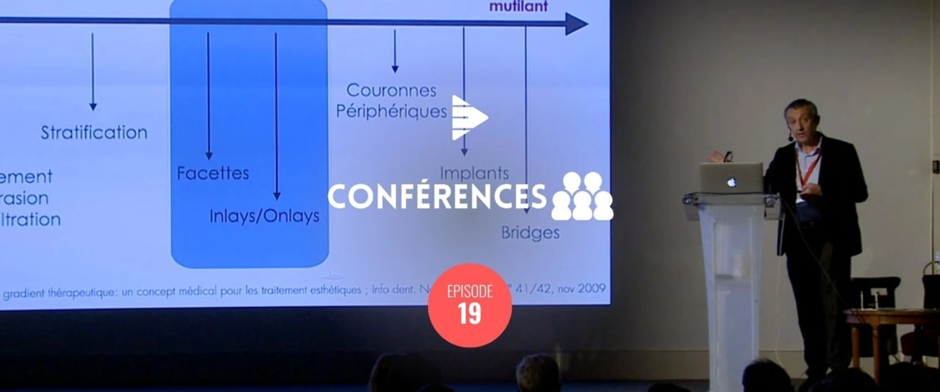 Bridges collés Cantilever